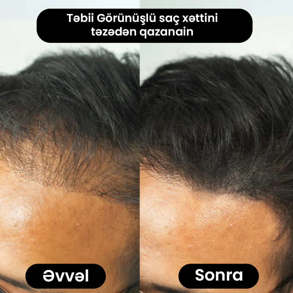 SAÇLY Saç Pudrası