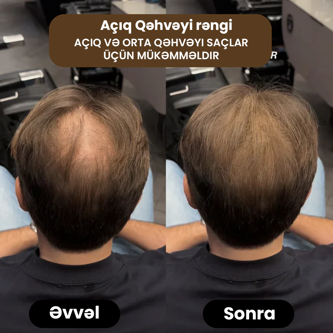 SAÇLY Saç Pudrası