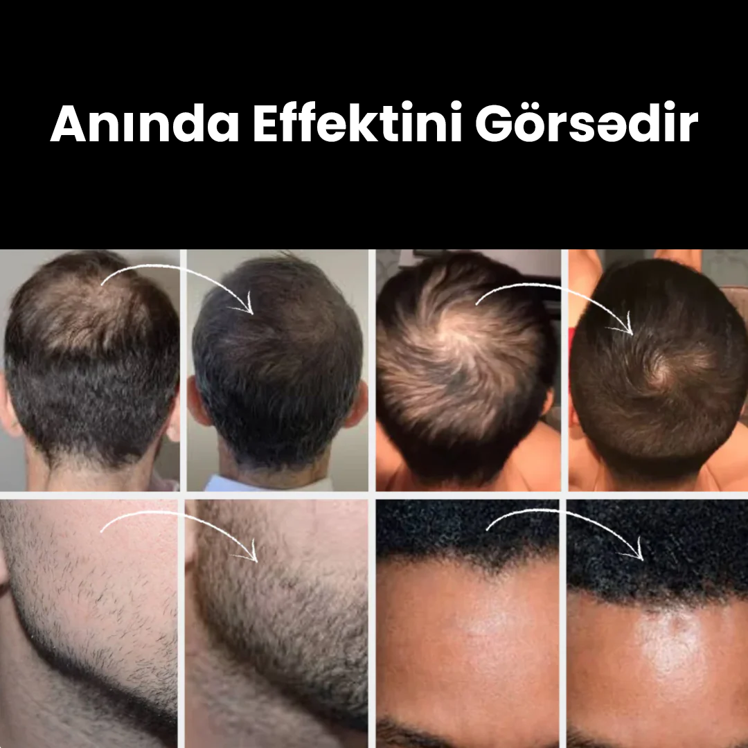 SAÇLY Saç Pudrası